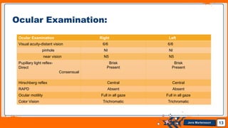 Jens Martensson 13
Ocular Examination:
Ocular Examination Right Left
Visual acuity-distant vision 6/6 6/6
pinhole NI NI
near vision N5 N5
Pupillary light reflex-
Direct
Consensual
Brisk
Present
Brisk
Present
Hirschberg reflex Central Central
RAPD Absent Absent
Ocular motility Full in all gaze Full in all gaze
Color Vision Trichromatic Trichromatic
 