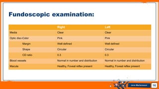 Jens Martensson
Right Left
Media Clear Clear
Optic disc-Color Pink Pink
Margin Well defined Well defined
Shape Circular Circular
CD ratio 0.3 0.3
Blood vessels Normal in number and distribution Normal in number and distribution
Macula Healthy, Foveal reflex present Healthy, Foveal reflex present
16
Fundoscopic examination:
 