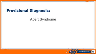Jens Martensson
Apert Syndrome
19
Provisional Diagnosis:
 