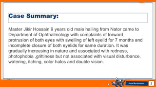 Jens Martensson
Master Jikir Hossain 9 years old male hailing from Nator came to
Department of Ophthalmology with complaints of forward
protrusion of both eyes with swelling of left eyelid for 7 months and
incomplete closure of both eyelids for same duration. It was
gradually increasing in nature and associated with redness,
photophobia ,grittiness but not associated with visual disturbance,
watering, itching, color halos and double vision.
3
Case Summary:
 
