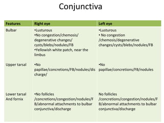 Case presentation on Hypertensive Retinopathy.pdf