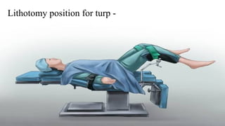 Lithotomy position for turp -
 