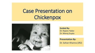 Case Presentation on
Chickenpox
Presentation By-
Dr. Sohan Khanna (JR2)
Guided By-
Dr. Rajeev Yadav
Dr. Manoj Gupta
 