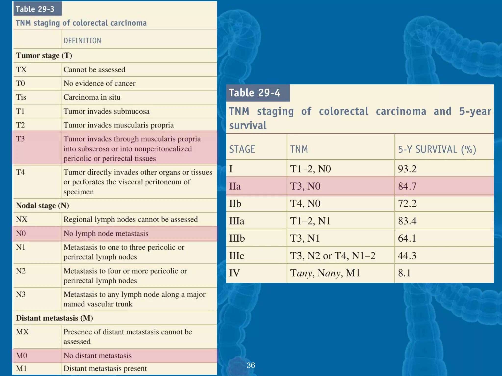 Colon Cancer - A Case Presentation | PPTX