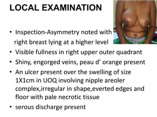 LOCAL EXAMINATION
• Inspection-Asymmetry noted with
right breast lying at a higher level
• Visible fullness in right upper outer quadrant
• Shiny, engorged veins, peau d’ orange present
• An ulcer present over the swelling of size
1X1cm in UOQ involving nipple areoler
complex,irregular in shape,everted edges and
floor with pale necrotic tissue
• serous discharge present
 