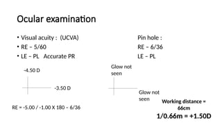 Case presentation- Phacomorphic glaucoma | PPTX