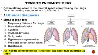 Hunger Neck Case Presentation: High-Velocity RTA with Multisystem Trauma- RTA.pptx