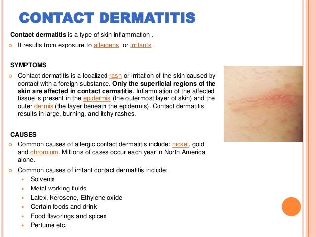 Stasis Dermatitis - Case Presentation