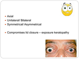 Axial
 Unilateral/ Bilateral
 Symmetrical/ Asymmetrical
 Compromises lid closure – exposure keratopathy
 
