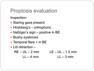 Proptosis evaluation
Inspection-
 Staring gaze present
 Hirshberg’s – orthophoric
 Nafziger’s sign – positive in BE
 Bushy eyebrows
 Temporal flare + in BE
 Lid retraction –
RE – UL – 2 mm LE – UL – 1.5 mm
LL – 4 mm LL – 3 mm
 