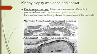 Effacement Testing case presentation: generalized edema | PPTX