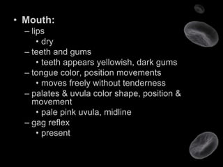 Uvula Color Nursing case presentation | PPT