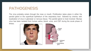 PATHOGENESIS
The virus probably enters through the nose or mouth. Proliferation takes place in either the
parotid gland or the superficial epithelium of the respiratory tract followed by viremia, with
localization of virus in glandular or nervous tissue. The parotid gland is most involved. Mumps
virus has been isolated from human saliva, blood, urine, and CSF during the acute phase of
illness.
 
