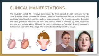 CLINICAL MANIFESTATIONS
The incubation period 16 – 18 days, transmission by direct contact, droplet, vomit, and may be
urine. Parotitis, either unilateral or bilateral, additional manifestation include submaxillary and
sublingual gland infection, orchitis, and meningoencephalitis. Pancreatitis, oovoritis, thyroiditis,
and other glandular infections are rare. The classic illness is ushered by fever, headache,
anorexia, and malaise. Within 24 hours the child complaints of an “earache”. Rapidly progress to
its maximum size within 1 to 3 days. The fever subsides after period 1 to 6 days.
 
