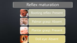 case presentation on delayed development | PPTX