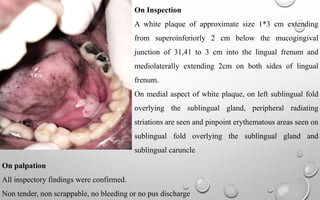 On Inspection
A white plaque of approximate size 1*3 cm extending
from superoinferiorly 2 cm below the mucogingival
junction of 31,41 to 3 cm into the lingual frenum and
mediolaterally extending 2cm on both sides of lingual
frenum.
On medial aspect of white plaque, on left sublingual fold
overlying the sublingual gland, peripheral radiating
striations are seen and pinpoint erythematous areas seen on
sublingual fold overlying the sublingual gland and
sublingual caruncle
On palpation
All inspectory findings were confirmed.
Non tender, non scrappable, no bleeding or no pus discharge
 