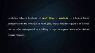 tobacco snort Tobacco Snuff: Wide Selection of Global Brands – Mr Snuff