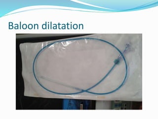 Baloon dilatation