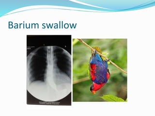 Barium swallow