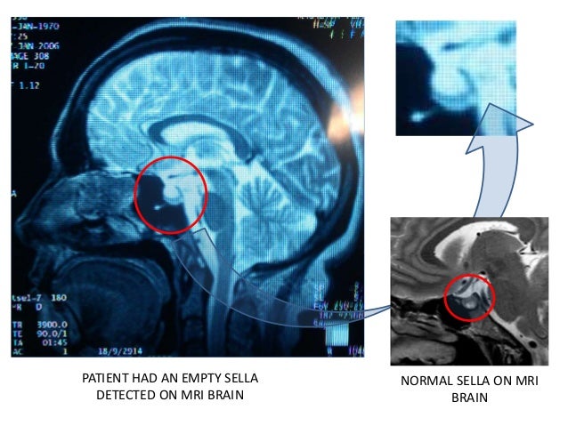 24 Hour Ecg >> GRAND ROUNDS : Anterior ischemic optic neuropathy with ... 24 Hour Ecg >> GRAND ROUNDS : Anterior ischemic optic neuropathy with ...