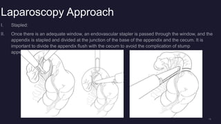 CASE Report General Surgery Residency Presentation Appendicitis.pptx