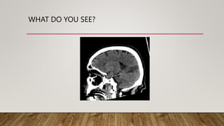 WHAT DO YOU SEE?
 