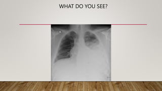 WHAT DO YOU SEE?
 