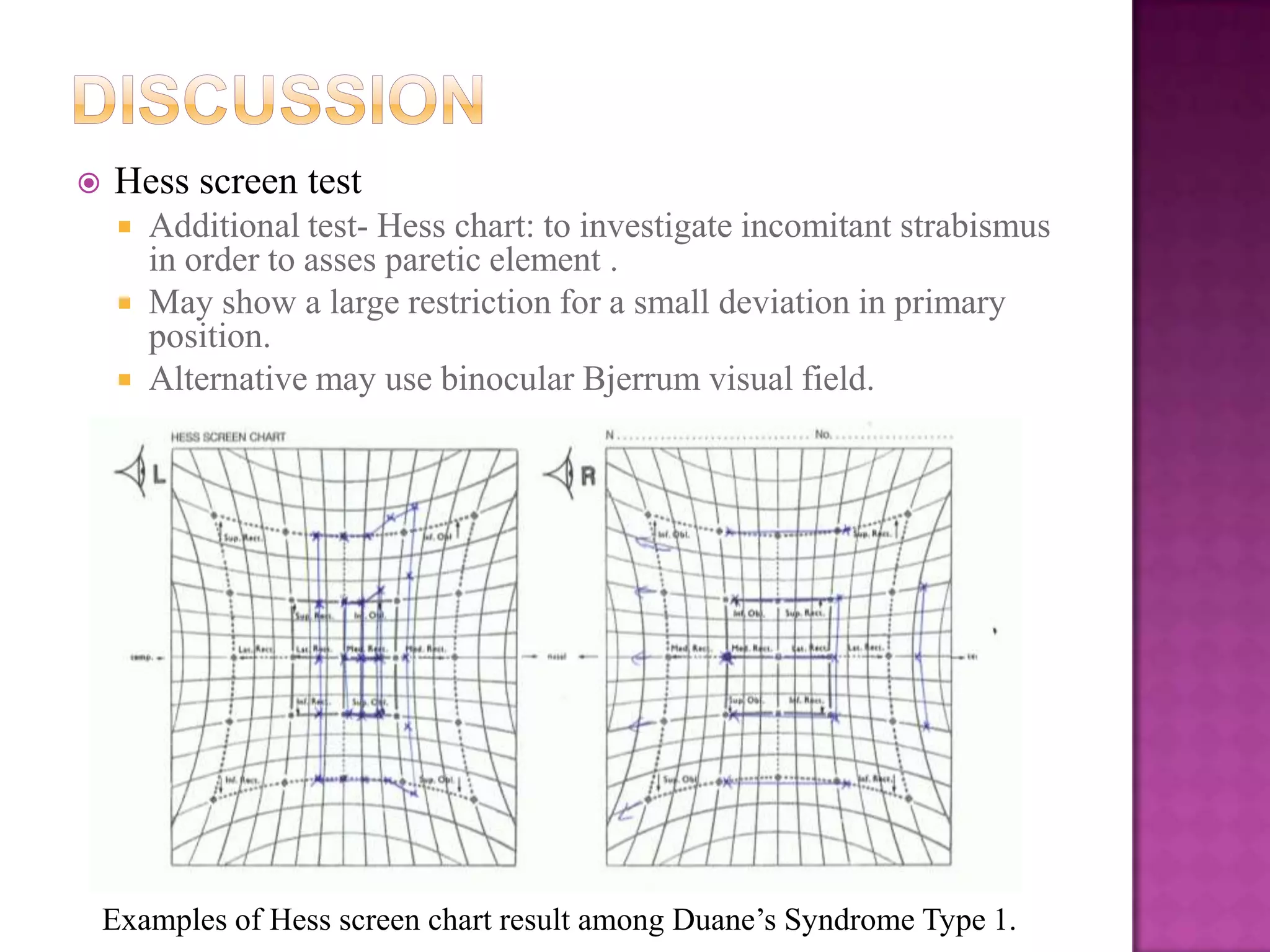 

Hess screen test




Additional test- Hess chart: to investigate incomitant strabismus
in order to asses paretic element .
May show a large restriction for a small deviation in primary
position.
Alternative may use binocular Bjerrum visual field.

Examples of Hess screen chart result among Duane’s Syndrome Type 1.

 