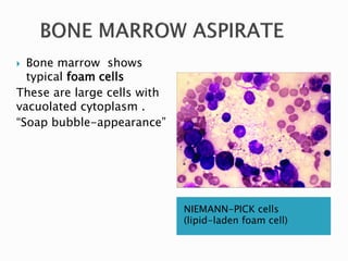 NIEMANN-PICK cells
(lipid-laden foam cell)
 Bone marrow shows
typical foam cells
These are large cells with
vacuolated cytoplasm .
“Soap bubble-appearance”
 