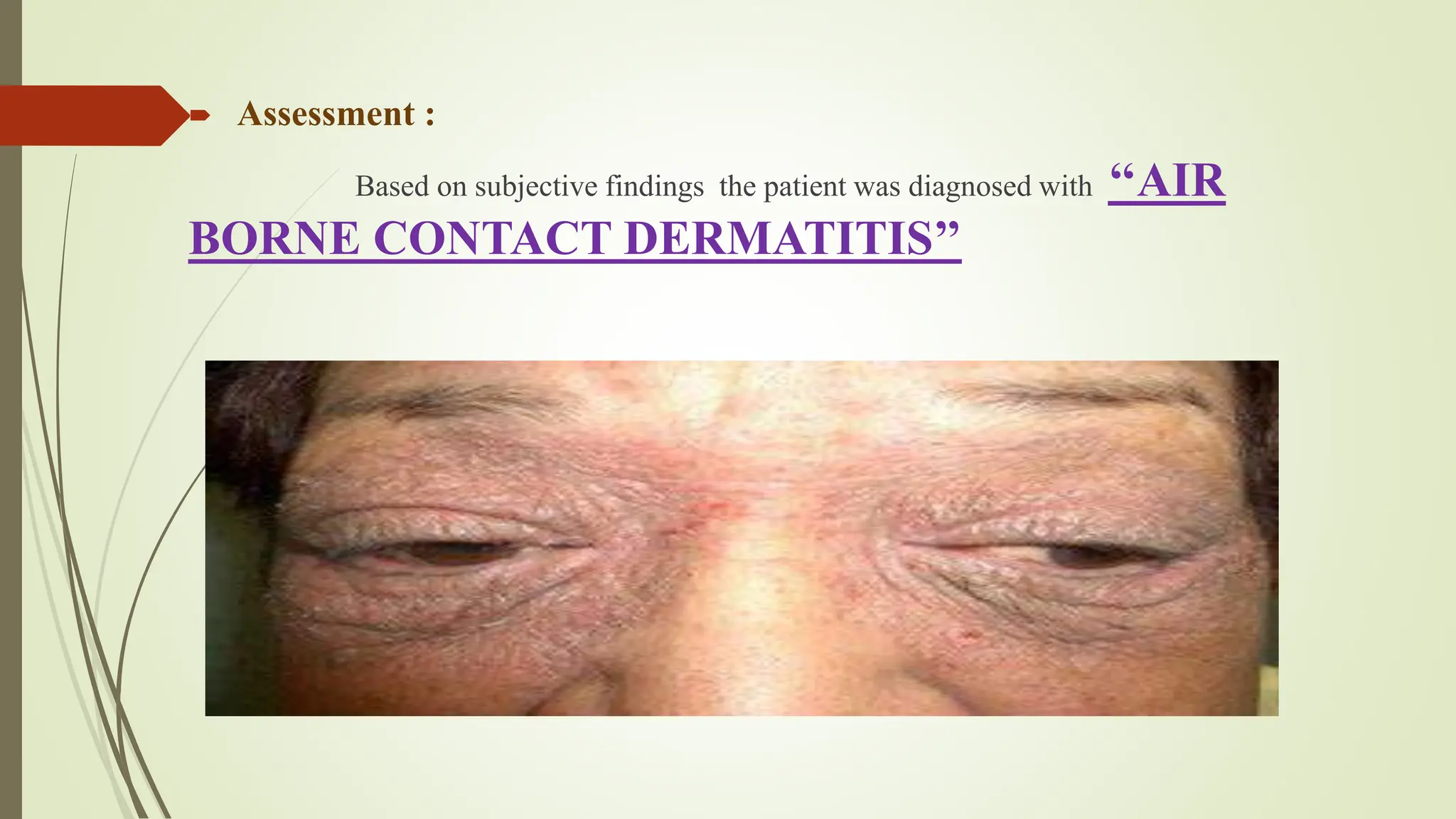 CASE PRESENTATION derma2 pptx.pptx