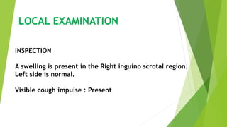 LOCAL EXAMINATION
INSPECTION
A swelling is present in the Right inguino scrotal region.
Left side is normal.
Visible cough impulse : Present
 