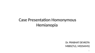 Homonymous Project Homonymous Hemianopia Case Presentation Dr. Prabhat Devkota.pptx