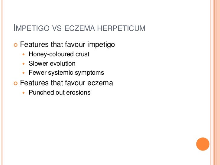 Case presentation eczema herpeticum