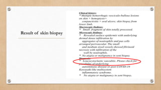 Result of skin biopsy
 