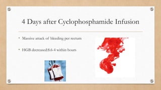 4 Days after Cyclophosphamide Infusion
• Massive attack of bleeding per rectum
• HGB decreased:8.6-4 within hours
 