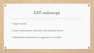 GIT endoscopy
• Upper :normal
• Lower :erythematous ,edematous and ulcerated mucosa
• Pathological examination was suggestive of vasculitis
 