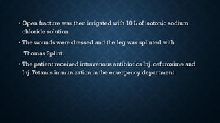 • Open fracture was then irrigated with 10 L of isotonic sodium
chloride solution.
• The wounds were dressed and the leg was splinted with
Thomas Splint.
• The patient received intravenous antibiotics Inj. cefuroxime and
Inj.Tetanus immunization in the emergency department.
 