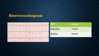 Electrocardiogram
ECG normal
Heart Rate 70 bpm
Rhythm Regular
 