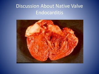 Discussion About Native Valve
Endocarditis
 