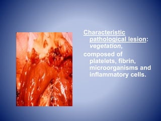 Characteristic
pathological lesion:
vegetation,
composed of
platelets, fibrin,
microorganisms and
inflammatory cells.
 