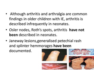 • Although arthritis and arthralgia are common
findings in older children with IE, arthritis is
described infrequently in neonates.
• Osler nodes, Roth’s spots, arthritis have not
been described in neonates.
• Janeway lesions,generalised petechial rash
and splinter hemmorages have been
documented.
 