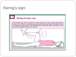 Kernig’s sign:
 