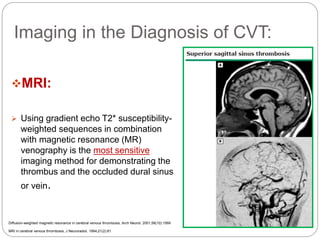 Imaging in the Diagnosis of CVT:
MRI:
 Using gradient echo T2* susceptibility-
weighted sequences in combination
with magnetic resonance (MR)
venography is the most sensitive
imaging method for demonstrating the
thrombus and the occluded dural sinus
or vein.
Diffusion-weighted magnetic resonance in cerebral venous thrombosis, Arch Neurol. 2001;58(10):1569
MRI in cerebral venous thrombosis, J Neuroradiol. 1994;21(2):81
 