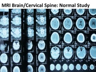 MRI Brain/Cervical Spine: Normal Study
 