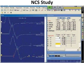 NCS Study
 
