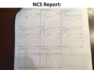 NCS Report:
 
