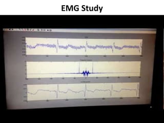 EMG Study
 