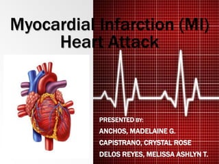 Myocardial Infarction (MI)
Heart Attack
PRESENTED BY:
ANCHOS, MADELAINE G.
CAPISTRANO, CRYSTAL ROSE
DELOS REYES, MELISSA ASHLYN T.
 