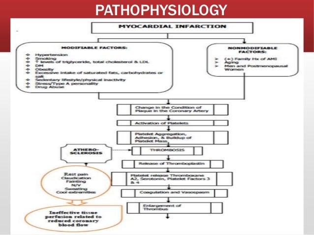 Myocardial Infarction Pathophysiology Flow Chart