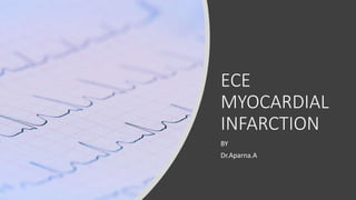 ECE
MYOCARDIAL
INFARCTION
BY
Dr.Aparna.A
 